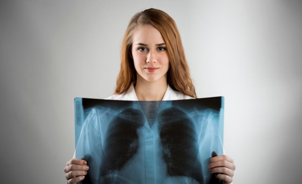 Young women get lung cancer at higher rates than mensss
